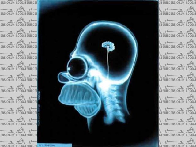 Rescued attachment Simpson_headXray.jpg